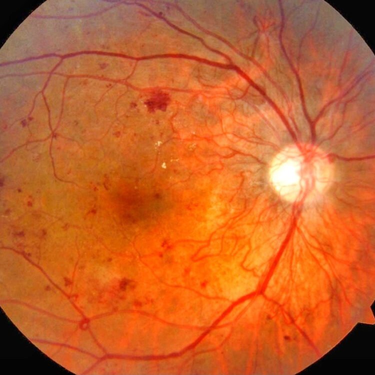 Affordable & Advanced Eye Care in Karimnagar | Retina Screening & Modular OT